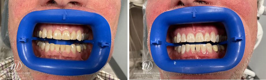 Zoom whitening service near 44145
